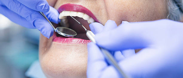 Best Emergency Treatment for Toothache in Northampton, MA